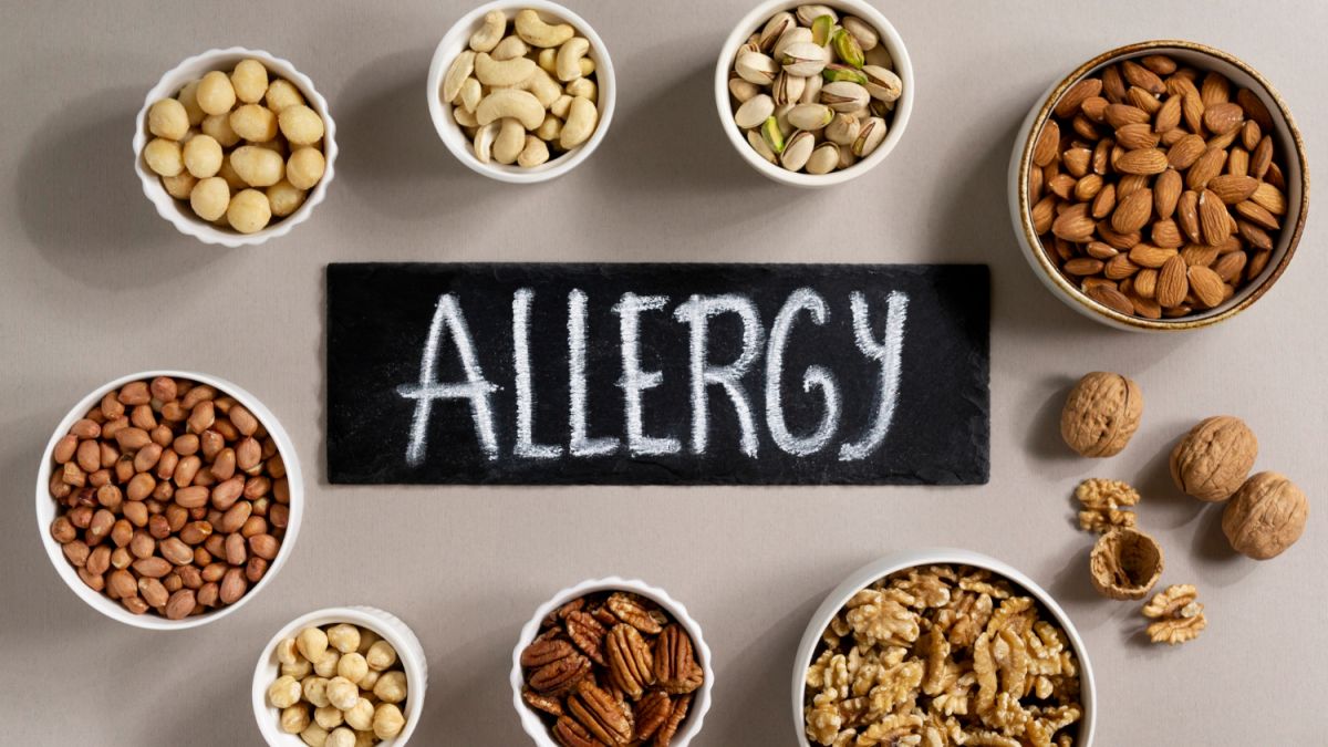 Dagelijks leven met allergieën - Mensen met een allergie moeten op deze punten letten als het om voedsel gaat